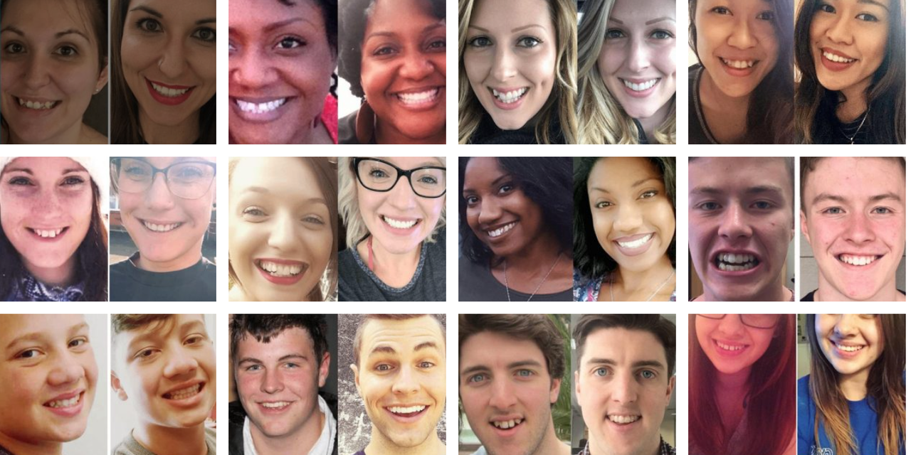 Impact Orthodontics: Transforming Smiles and Boosting Confidence in the Community